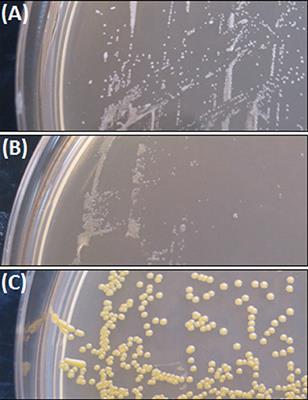 Deferiprone and Gallium-Protoporphyrin Have the Capacity to Potentiate the Activity of Antibiotics in Staphylococcus aureus Small Colony Variants